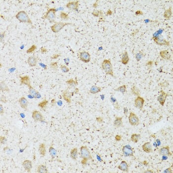 Immunohistochemistry COG2 Antibody