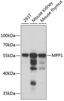 Western Blot: MPP1 Antibody [NBP3-38238] - Western blot analysis of various lysates using MPP1 Rabbit pAb at 1:1000 dilution.Secondary antibody: HRP-conjugated Goat anti-Rabbit IgG (H+L) at 1:10000 dilution.Lysates/proteins: 25ug per lane.Blocking buffer: 3% nonfat dry milk in TBST.Detection: ECL Enhanced Kit.Exposure time: 60s.