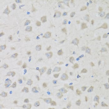 Immunohistochemistry: Proenkephalin Antibody [NBP3-38239] - Immunohistochemistry analysis of paraffin-embedded Mouse brain using Proenkephalin Rabbit pAb at dilution of 1:100 (40x lens). Microwave antigen retrieval performed with 0.01M PBS Buffer (pH 7.2) prior to IHC staining.