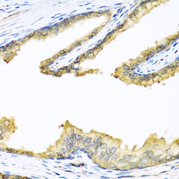 Immunohistochemistry: Proenkephalin Antibody [NBP3-38239] - Immunohistochemistry analysis of paraffin-embedded Human prostate using Proenkephalin Rabbit pAb at dilution of 1:100 (40x lens). Microwave antigen retrieval performed with 0.01M PBS Buffer (pH 7.2) prior to IHC staining.