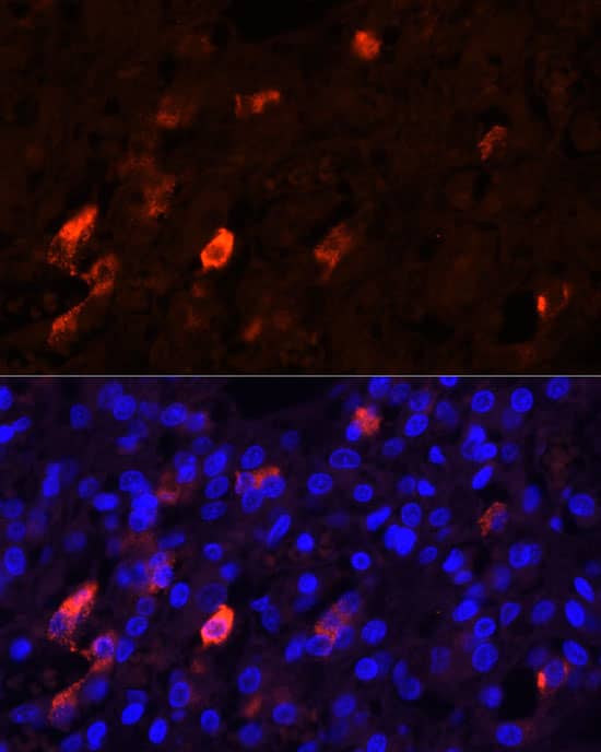 Immunocytochemistry/ Immunofluorescence: Proenkephalin Antibody [NBP3-38239] - Immunofluorescence analysis of paraffin-embedded Human adrenal gland using Proenkephalin Rabbit pAb at dilution of 1:20 (40x lens). Secondary antibody: Cy3-conjugated Goat anti-Rabbit IgG (H+L) at 1:500 dilution. Blue: DAPI for nuclear staining.