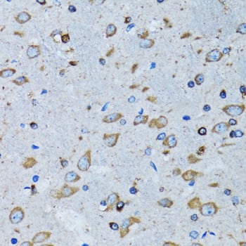 Immunohistochemistry: Arginyl tRNA synthetase Antibody [NBP3-38241] - Immunohistochemistry analysis of paraffin-embedded Mouse brain using Arginyl tRNA synthetase Rabbit pAb at dilution of 1:100 (40x lens). Microwave antigen retrieval performed with 0.01M PBS Buffer (pH 7.2) prior to IHC staining.