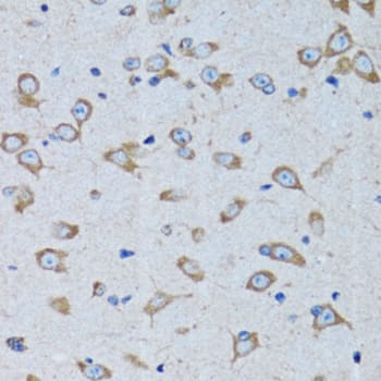 Immunohistochemistry: Arginyl tRNA synthetase Antibody [NBP3-38241] - Immunohistochemistry analysis of paraffin-embedded Rat brain using Arginyl tRNA synthetase Rabbit pAb at dilution of 1:100 (40x lens). Microwave antigen retrieval performed with 0.01M PBS Buffer (pH 7.2) prior to IHC staining.