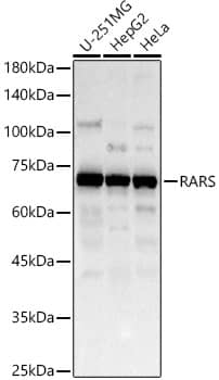 Western Blot: Arginyl tRNA synthetase Antibody [NBP3-38241] - Western blot analysis of various lysates, using Arginyl tRNA synthetase Rabbit pAb at 1:1000 dilution.&lt;br/&gt;Secondary antibody: HRP-conjugated Goat anti-Rabbit IgG (H+L) at 1:10000 dilution.&lt;br/&gt;Lysates/proteins: 25ug per lane.&lt;br/&gt;Blocking buffer: 3% nonfat dry milk in TBST.&lt;br/&gt;Detection: ECL Basic Kit.&lt;br/&gt;Exposure time: 60s.