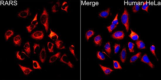 Immunocytochemistry/ Immunofluorescence: Arginyl tRNA synthetase Antibody [NBP3-38241] - Immunofluorescence analysis of HeLa cells using Arginyl tRNA synthetase Rabbit pAb at dilution of 1:100 (40x lens). Secondary antibody: Cy3-conjugated Goat anti-Rabbit IgG (H+L) at 1:500 dilution. Blue: DAPI for nuclear staining.