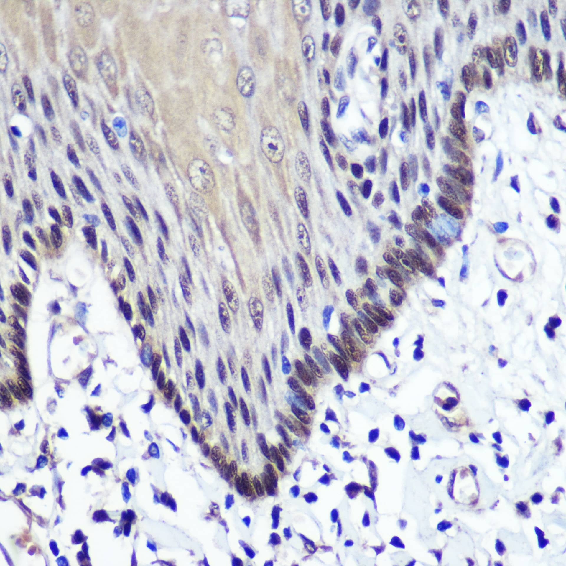 Immunohistochemistry: Transketolase Antibody [NBP3-38242] - Immunohistochemistry analysis of paraffin-embedded Human esophageal using Transketolase Rabbit pAb at dilution of 1:100 (40x lens). Microwave antigen retrieval performed with 0.01M PBS Buffer (pH 7.2) prior to IHC staining.