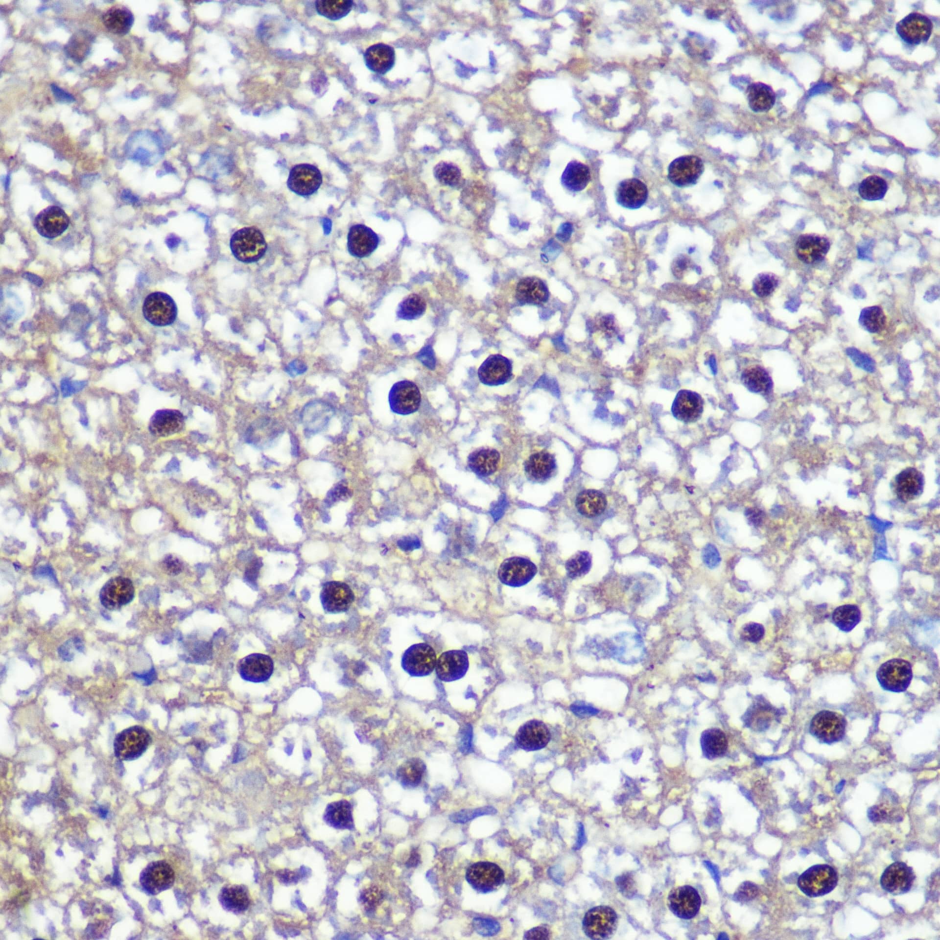 Immunohistochemistry: Transketolase Antibody [NBP3-38242] - Immunohistochemistry analysis of paraffin-embedded Rat liver using Transketolase Rabbit pAb at dilution of 1:100 (40x lens). Microwave antigen retrieval performed with 0.01M PBS Buffer (pH 7.2) prior to IHC staining.