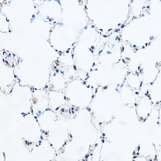 Immunohistochemistry GAS41 Antibody