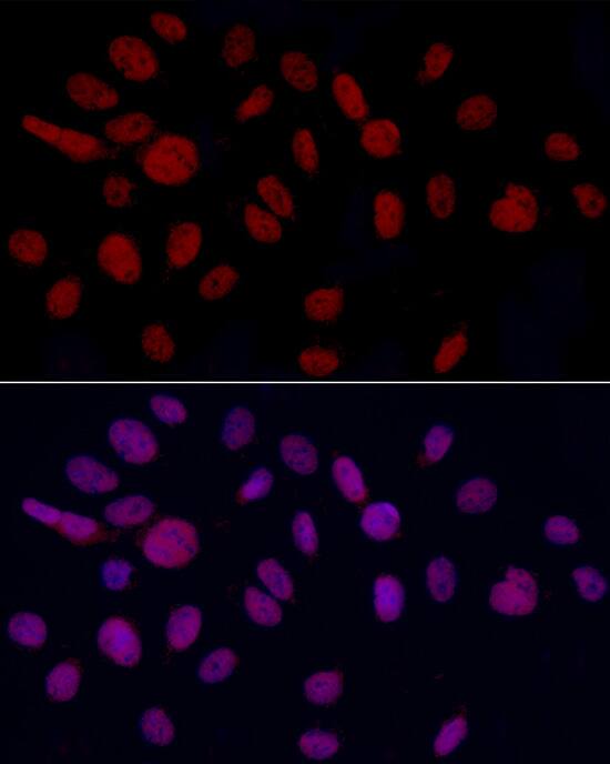 Immunocytochemistry/ Immunofluorescence: GAS41 Antibody [NBP3-38243] - Immunofluorescence analysis of U2OS cells using GAS41 Rabbit pAb at dilution of 1:50 (40x lens). Secondary antibody: Cy3-conjugated Goat anti-Rabbit IgG (H+L) at 1:500 dilution. Blue: DAPI for nuclear staining.