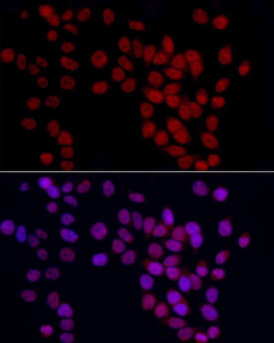 Immunocytochemistry/ Immunofluorescence GAS41 Antibody