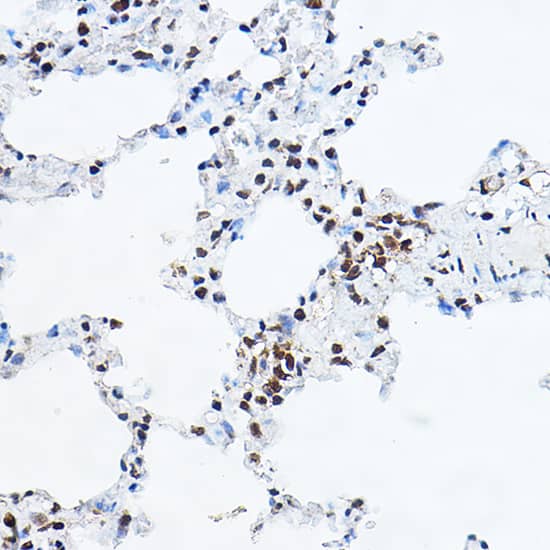 Immunohistochemistry: GAS41 Antibody [NBP3-38243] - Immunohistochemistry analysis of paraffin-embedded Rat lung using GAS41 Rabbit pAb at dilution of 1:100 (40x lens). High pressure antigen retrieval performed with 0.01M Citrate Bufferr (pH 6.0) prior to IHC staining.