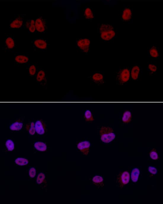 Immunocytochemistry/ Immunofluorescence: GAS41 Antibody [NBP3-38243] - Immunofluorescence analysis of A-549 cells using GAS41 Rabbit pAb at dilution of 1:50 (40x lens). Secondary antibody: Cy3-conjugated Goat anti-Rabbit IgG (H+L) at 1:500 dilution. Blue: DAPI for nuclear staining.