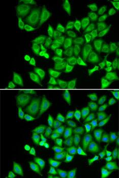 Immunocytochemistry/ Immunofluorescence: DHRS9 Antibody [NBP3-38244] - Immunofluorescence analysis of U2OS cells using DHRS9 Rabbit pAb. Secondary antibody: Cy3-conjugated Goat anti-Rabbit IgG (H+L) at 1:500 dilution. Blue: DAPI for nuclear staining.