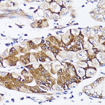 Immunohistochemistry: BAP29 Antibody [NBP3-38246] - Immunohistochemistry analysis of paraffin-embedded Human stomach using BAP29 Rabbit pAb at dilution of 1:100 (40x lens). Microwave antigen retrieval performed with 0.01M PBS Buffer (pH 7.2) prior to IHC staining.