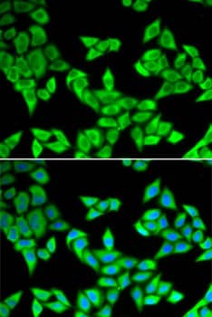 Immunocytochemistry/ Immunofluorescence: CIAPIN1 Antibody [NBP3-38247] - Immunofluorescence analysis of U2OS cells using CIAPIN1 Rabbit pAb. Secondary antibody: Cy3-conjugated Goat anti-Rabbit IgG (H+L) at 1:500 dilution. Blue: DAPI for nuclear staining.