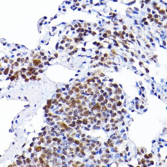 Immunohistochemistry: RCC1 Antibody [NBP3-38248] - Immunohistochemistry analysis of paraffin-embedded Rat lung using RCC1 Rabbit pAb at dilution of 1:200 (40x lens). High pressure antigen retrieval performed with 0.01M Citrate Bufferr (pH 6.0) prior to IHC staining.