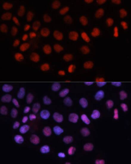 Immunocytochemistry/ Immunofluorescence: RCC1 Antibody [NBP3-38248] - Immunofluorescence analysis of HeLa cells using RCC1 Rabbit pAb at dilution of 1:100. Secondary antibody: Cy3-conjugated Goat anti-Rabbit IgG (H+L) at 1:500 dilution. Blue: DAPI for nuclear staining.