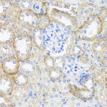 Immunohistochemistry: Argininosuccinate Lyase Antibody [NBP3-38249] - Immunohistochemistry analysis of paraffin-embedded Mouse kidney using Argininosuccinate Lyase Rabbit pAb at dilution of 1:100 (40x lens). Microwave antigen retrieval performed with 0.01M PBS Buffer (pH 7.2) prior to IHC staining.