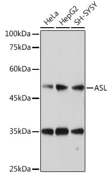 Western Blot: Argininosuccinate Lyase Antibody [NBP3-38249] - Western blot analysis of various lysates using Argininosuccinate Lyase Rabbit pAb at 1:1000 dilution.Secondary antibody: HRP-conjugated Goat anti-Rabbit IgG (H+L) at 1:10000 dilution.Lysates/proteins: 25ug per lane.Blocking buffer: 3% nonfat dry milk in TBST.Detection: ECL Basic Kit.Exposure time: 1s.