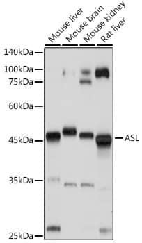 Western Blot: Argininosuccinate Lyase Antibody [NBP3-38249] - Western blot analysis of various lysates using Argininosuccinate Lyase Rabbit pAb at 1:1000 dilution.Secondary antibody: HRP-conjugated Goat anti-Rabbit IgG (H+L) at 1:10000 dilution.Lysates/proteins: 25ug per lane.Blocking buffer: 3% nonfat dry milk in TBST.Detection: ECL Basic Kit.Exposure time: 1s.