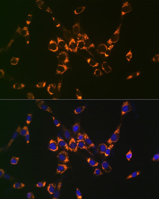 Immunocytochemistry/ Immunofluorescence: Argininosuccinate Lyase Antibody [NBP3-38249] - Immunofluorescence analysis of NIH-3T3 cells using Argininosuccinate Lyase Rabbit pAb at dilution of 1:100 (40x lens). Secondary antibody: Cy3-conjugated Goat anti-Rabbit IgG (H+L) at 1:500 dilution. Blue: DAPI for nuclear staining.