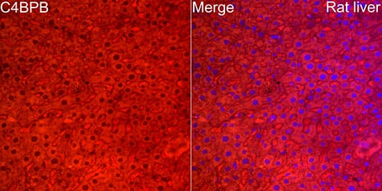 Immunohistochemistry: C4 binding protein B Antibody [NBP3-38250] - Perform high pressure antigen retrieval with 10 mM citrate buffer pH 6.0 before commencing with IF staining protocol.Immunofluorescence analysis of paraffin-embedded rat liver using C4BPB Rabbit pAb at dilution of 1:100 (40x lens). Secondary antibody: Cy3-conjugated Goat anti-Rabbit IgG (H+L) at 1:500 dilution. Blue: DAPI for nuclear staining.