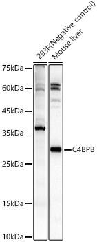 Western Blot: C4 binding protein B Antibody [NBP3-38250] - Western blot analysis of various lysates, using C4 binding protein B Rabbit pAb at 1:900 dilution.Secondary antibody: HRP-conjugated Goat anti-Rabbit IgG (H+L) at 1:10000 dilution.Lysates/proteins: 25ug per lane.Blocking buffer: 3% nonfat dry milk in TBST.Detection: ECL Basic Kit.Exposure time: 10s.