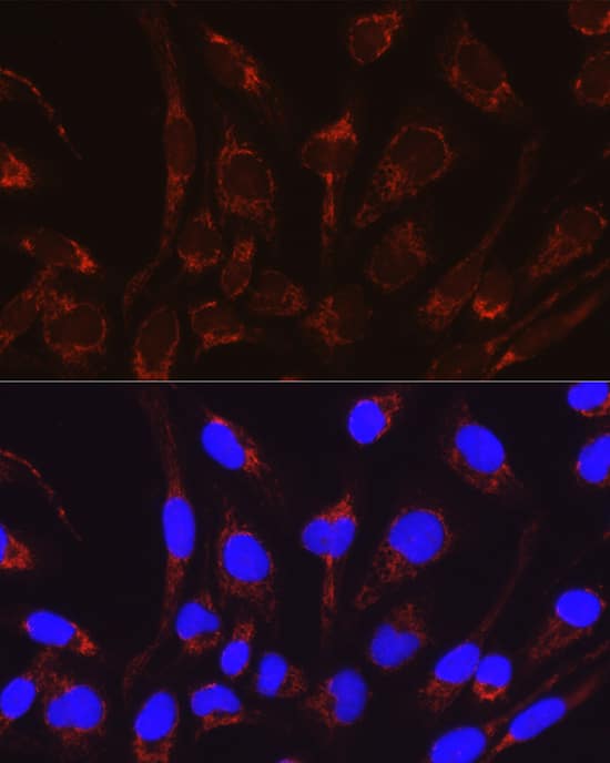 Immunocytochemistry/ Immunofluorescence: CRAT Antibody [NBP3-38251] - Immunofluorescence analysis of RD cells using CRAT Rabbit pAb at dilution of 1:50 (40x lens). Secondary antibody: Cy3-conjugated Goat anti-Rabbit IgG (H+L) at 1:500 dilution. Blue: DAPI for nuclear staining.