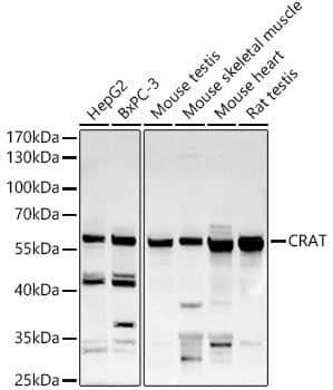 Western Blot: CRAT Antibody [NBP3-38251] - Western blot analysis of various lysates using CRAT Rabbit pAb at 1:500 dilution.Secondary antibody: HRP-conjugated Goat anti-Rabbit IgG (H+L) at 1:10000 dilution.Lysates/proteins: 25ug per lane.Blocking buffer: 3% nonfat dry milk in TBST.Detection: ECL Basic Kit.Exposure time: 90s.