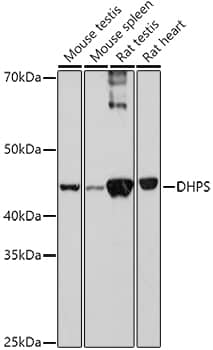 Western Blot: DHPS Antibody [NBP3-38252] - Western blot analysis of various lysates using DHPS Rabbit pAb at 1:1000 dilution.Secondary antibody: HRP-conjugated Goat anti-Rabbit IgG (H+L) at 1:10000 dilution.Lysates/proteins: 25ug per lane.Blocking buffer: 3% nonfat dry milk in TBST.Detection: ECL Basic Kit.Exposure time: 180s.