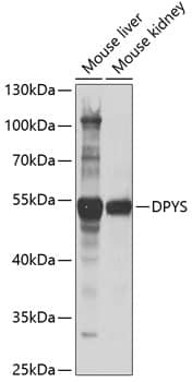 Western Blot DPYS Antibody