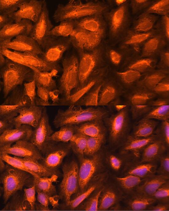 Immunocytochemistry/ Immunofluorescence DTYMK Antibody