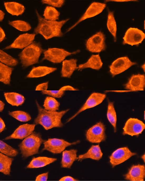 Immunocytochemistry/ Immunofluorescence: DTYMK Antibody [NBP3-38254] - Immunofluorescence analysis of L929 cells using DTYMK Rabbit pAb at dilution of 1:100 (40x lens). Secondary antibody: Cy3-conjugated Goat anti-Rabbit IgG (H+L) at 1:500 dilution. Blue: DAPI for nuclear staining.