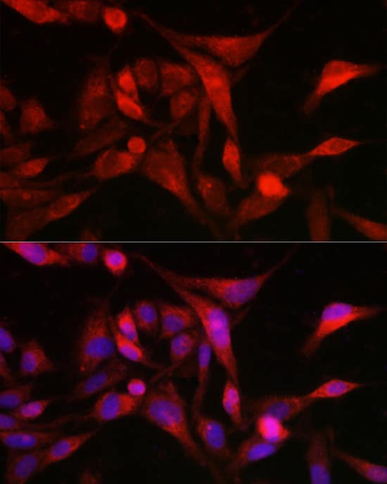 Immunocytochemistry/ Immunofluorescence: Methionine Sulfoxide Reductase A Antibody [NBP3-38255] - Immunofluorescence analysis of U2OS cells using Methionine Sulfoxide Reductase A Rabbit pAb at dilution of 1:300 (40x lens). Secondary antibody: Cy3-conjugated Goat anti-Rabbit IgG (H+L) at 1:500 dilution. Blue: DAPI for nuclear staining.