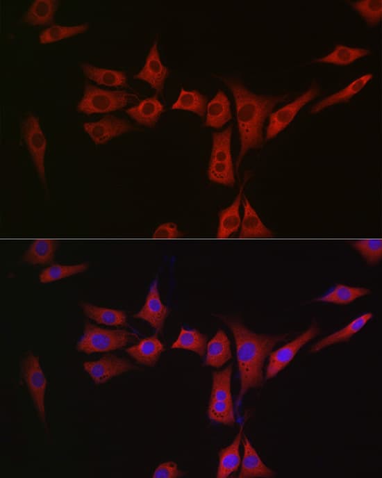 Immunocytochemistry/ Immunofluorescence Methionine Sulfoxide Reductase A Antibody