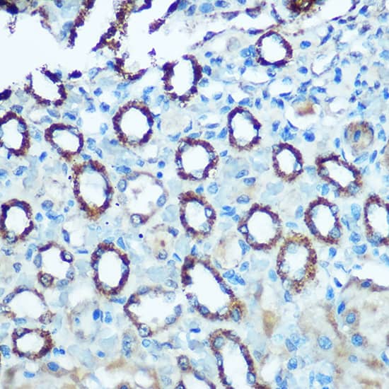 Immunohistochemistry: Ndufs4 Antibody [NBP3-38256] - Immunohistochemistry analysis of paraffin-embedded Rat kidney using Ndufs4 Rabbit pAb at dilution of 1:100 (40x lens). Microwave antigen retrieval performed with 0.01M Tris/EDTA Buffer (pH 9.0) prior to IHC staining.