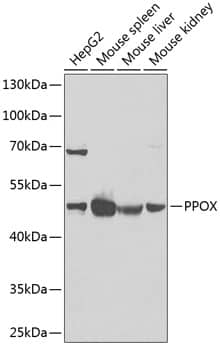 Western Blot: PPOX Antibody [NBP3-38257] - Western blot analysis of various lysates using PPOX Rabbit pAb at 1:1000 dilution.Secondary antibody: HRP-conjugated Goat anti-Rabbit IgG (H+L) at 1:10000 dilution.Lysates/proteins: 25ug per lane.Blocking buffer: 3% nonfat dry milk in TBST.Detection: ECL Enhanced Kit.Exposure time: 90s.