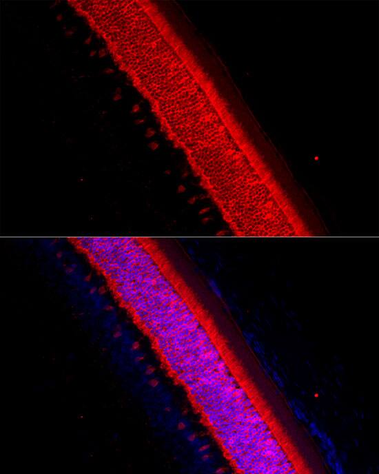 Immunocytochemistry/ Immunofluorescence Recoverin Antibody