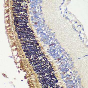 Immunohistochemistry Recoverin Antibody