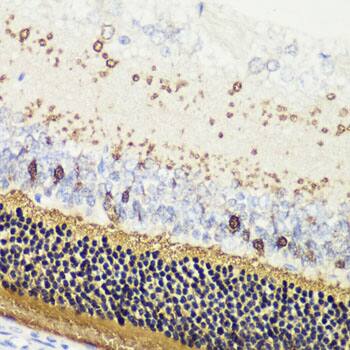 Immunohistochemistry Recoverin Antibody