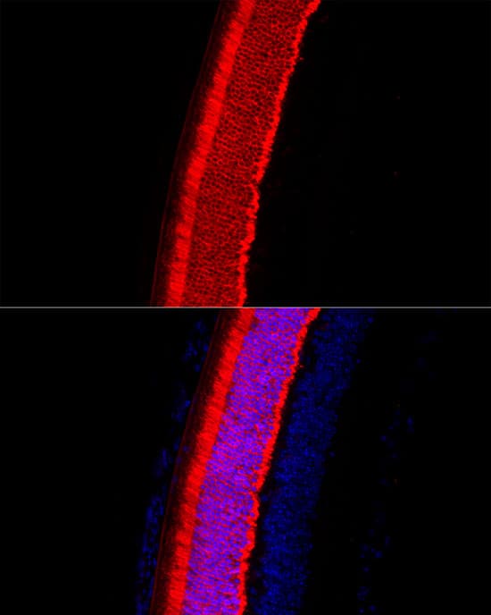 Immunocytochemistry/ Immunofluorescence: Recoverin Antibody [NBP3-38258] - Immunofluorescence analysis of paraffin-embedded mouse eye using Recoverin Rabbit pAb at dilution of 1:50 (40x lens). Secondary antibody: Cy3-conjugated Goat anti-Rabbit IgG (H+L) at 1:500 dilution. Blue: DAPI for nuclear staining.