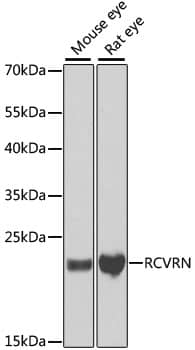 Western Blot: Recoverin Antibody [NBP3-38258] - Western blot analysis of various lysates using Recoverin Rabbit pAb at 1:1000 dilution.Secondary antibody: HRP-conjugated Goat anti-Rabbit IgG (H+L) at 1:10000 dilution.Lysates/proteins: 25ug per lane.Blocking buffer: 3% nonfat dry milk in TBST.Detection: ECL Basic Kit.Exposure time: 15s.