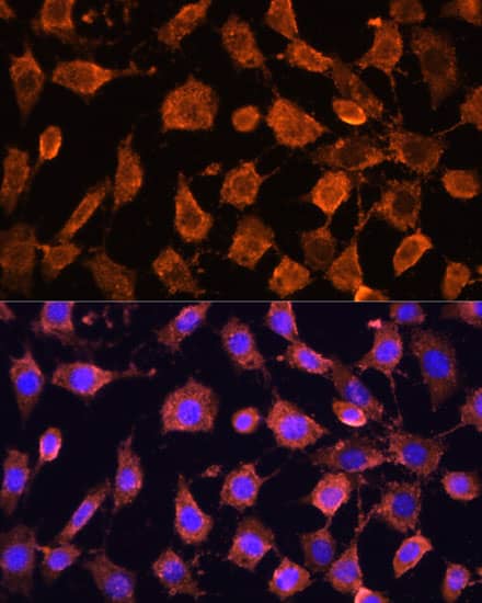 Immunocytochemistry/ Immunofluorescence: RPL11 Antibody [NBP3-38259] - Immunofluorescence analysis of L929 cells using RPL11 Rabbit pAb at dilution of 1:100. Secondary antibody: Cy3-conjugated Goat anti-Rabbit IgG (H+L) at 1:500 dilution. Blue: DAPI for nuclear staining.