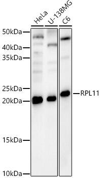 Western Blot: RPL11 Antibody [NBP3-38259] - Western blot analysis of various lysates, using RPL11 Rabbit pAb at 1:1000 dilution.Secondary antibody: HRP-conjugated Goat anti-Rabbit IgG (H+L) at 1:10000 dilution.Lysates/proteins: 25ug per lane.Blocking buffer: 3% nonfat dry milk in TBST.Detection: ECL Basic Kit.Exposure time: 60s.