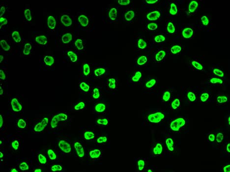 Immunocytochemistry/ Immunofluorescence: U1A Antibody [NBP3-38260] - Immunofluorescence analysis of HeLa cells using U1A Rabbit pAb.Secondary antibody: Cy3-conjugated Goat anti-Rabbit IgG (H+L) at 1:500 dilution.