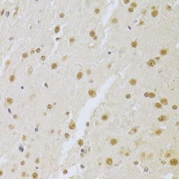 Immunohistochemistry: U1A Antibody [NBP3-38260] - Immunohistochemistry analysis of paraffin-embedded Mouse brain using U1A Rabbit pAb at dilution of 1:100 (40x lens). Microwave antigen retrieval performed with 0.01M PBS Buffer (pH 7.2) prior to IHC staining.