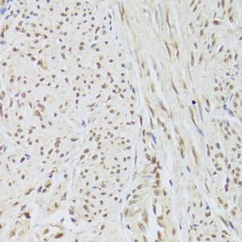 Immunohistochemistry U1A Antibody