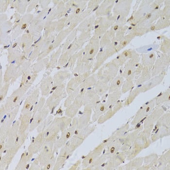 Immunohistochemistry U1A Antibody