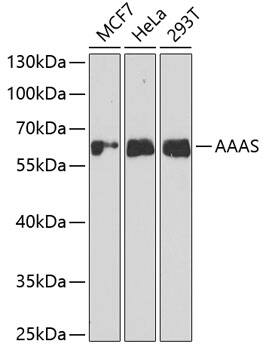 Western Blot: AAAS Antibody [NBP3-38262] - Western blot analysis of various lysates using AAAS Rabbit pAb at 1:1000 dilution.Secondary antibody: HRP-conjugated Goat anti-Rabbit IgG (H+L) at 1:10000 dilution.Lysates/proteins: 25ug per lane.Blocking buffer: 3% nonfat dry milk in TBST.Detection: ECL Basic Kit.Exposure time: 30s.