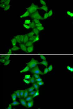 Immunocytochemistry/ Immunofluorescence BLZF1 Antibody - BSA Free